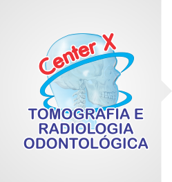 Center X